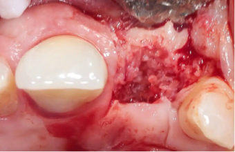 reopening-months-post-op