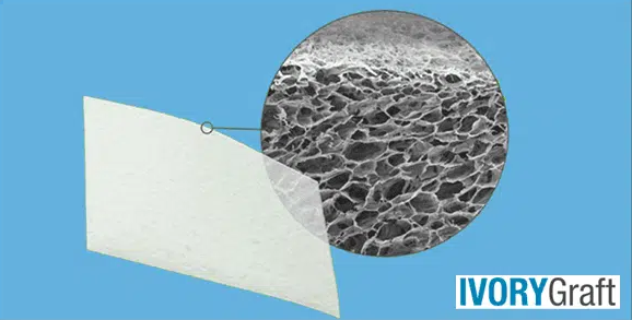 Dental Bone Graft – Accessories and additives