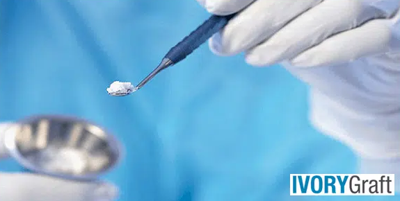 Dental Bone Graft – Procedure