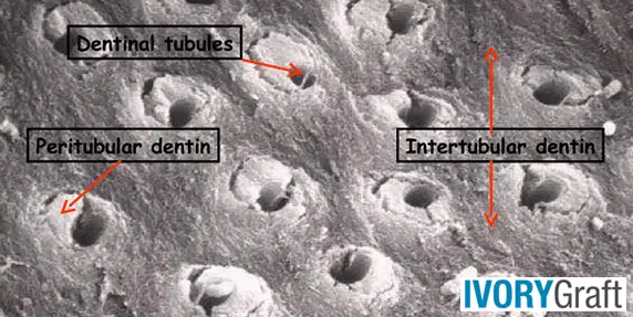 Dentin – Anatomy and Histology