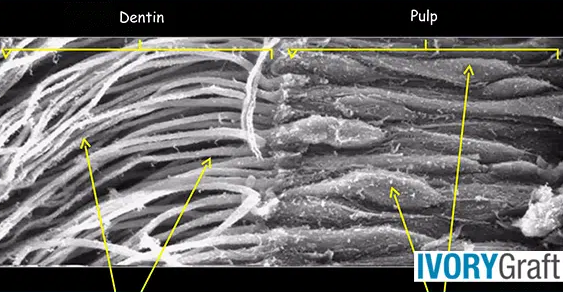 Dentin – Growth and Formation