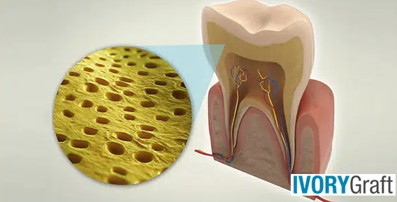 Dentin – Overview
